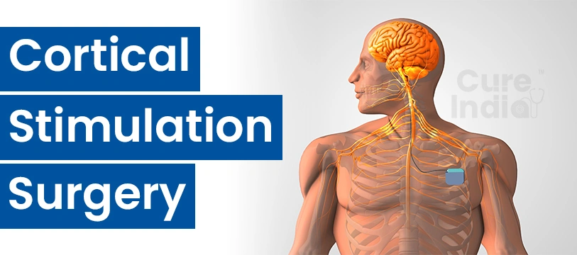 Cortical Stimulation Surgery in India